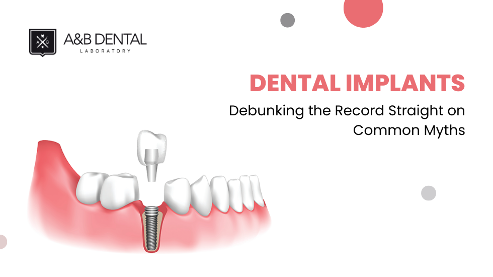 Dental Implants Debunking the Record Straight on Common Myths